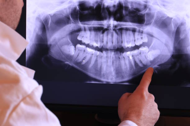 Best Cracked Tooth Emergency Dentist  in Miramar Beach, FL