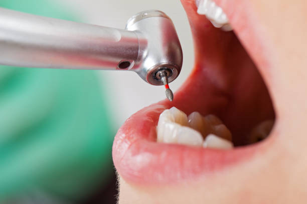 Best Tooth Infection Emergency Dentist  in Miramar Beach, FL